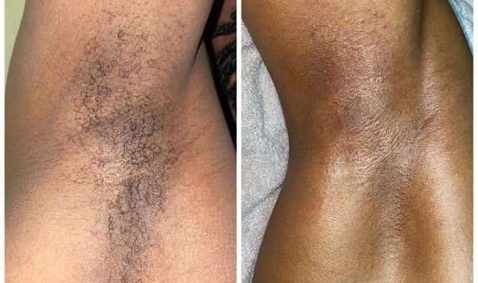 Skin tone comparison closeup